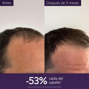 Caudalie Sérum Capilar Anticaída - Imagen 3
